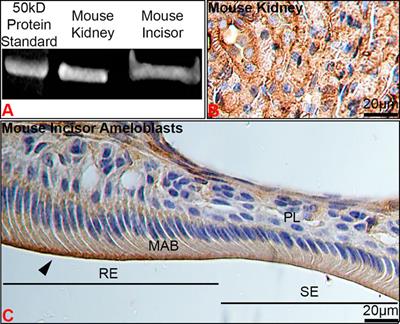 Na+ and K+ transport and maturation stage ameloblast modulation